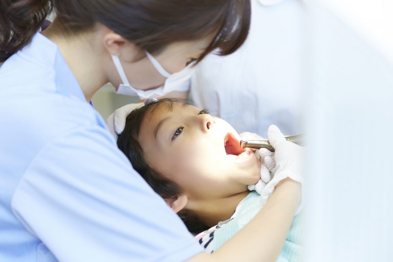 歯科医院でのプロフェッショナルケア