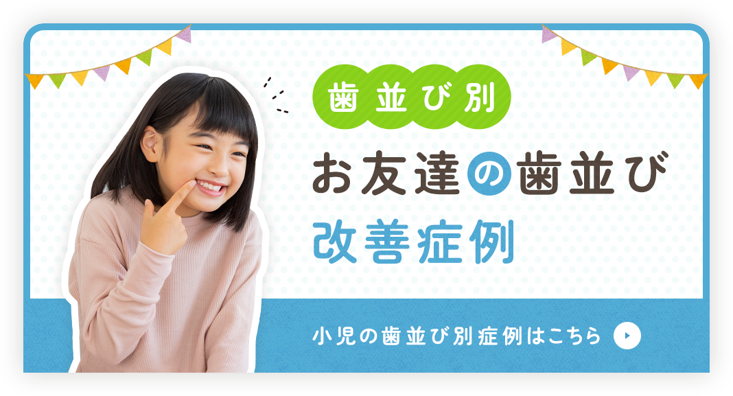 歯並び別 お友達の歯並び改善症例 小児の歯並び別症例はこちら